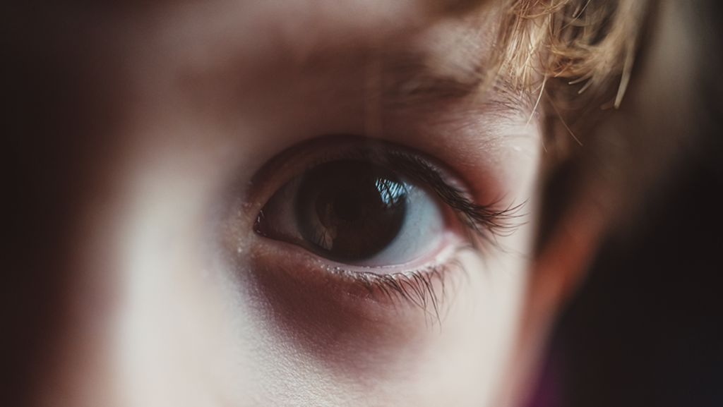 Lasik Eye Surgery Humbolt Park Chicago